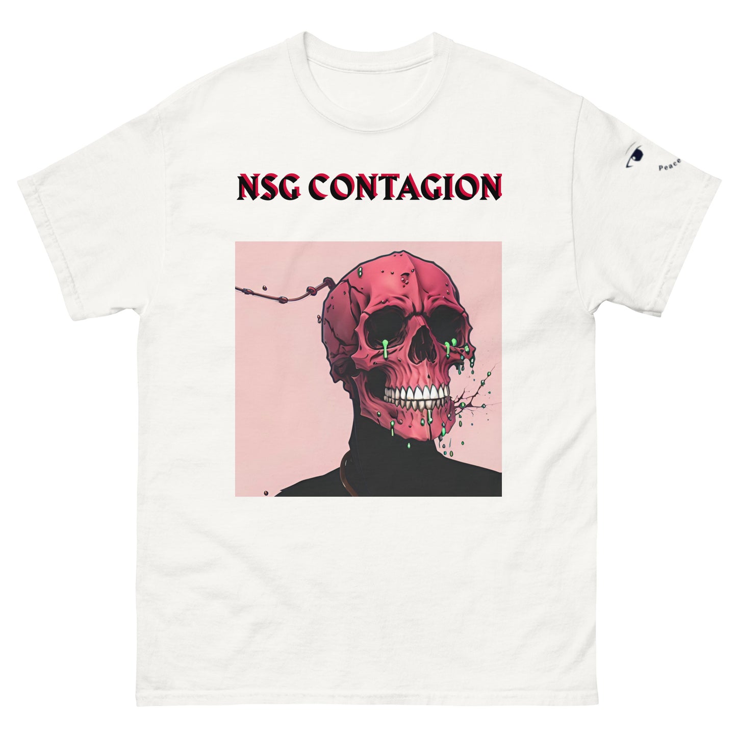 NSG contagion